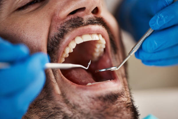 Best Chipped Tooth Repair Near Me  in Weston, OH