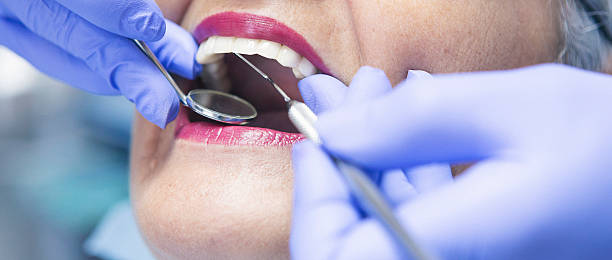 Best Knocked-Out Tooth Emergency  in Weston, OH